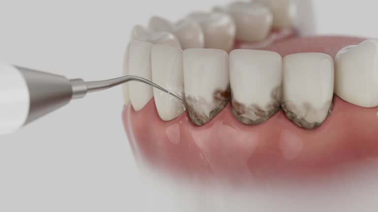 Reliable Dental Implants contractor in St. Henry, OH by Smile Center Dentistry